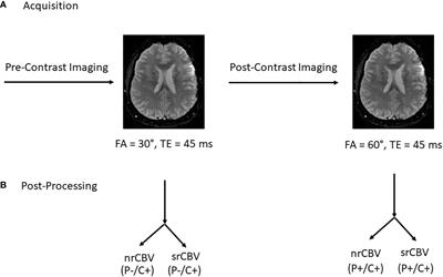 A cross-sectional study to test equivalence of low- versus intermediate-flip angle dynamic susceptibility contrast MRI measures of relative cerebral blood volume in patients with high-grade gliomas at 1.5 Tesla field strength